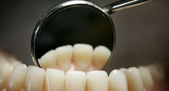 علاج جديد لتسوس الأسنان بدون حشو 