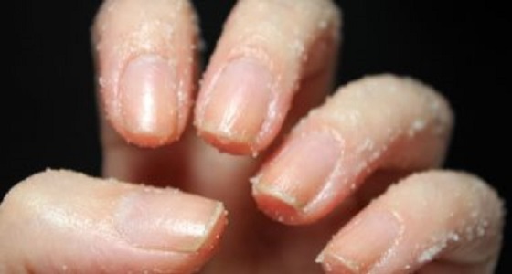 5 طرق سهلة للتخلص من الجلد الميت حول الأظافر