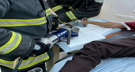 قصة إنقاذ يد مقيم من البتر داخل فرامة لحوم بالطائف