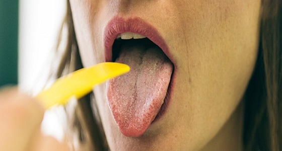 أسباب ” بياض اللسان ” ونصائح هامة للوقاية من مخاطره