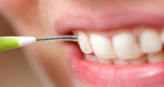 وصفة منزلية فعالة للتخلص من أمراض اللثة وحساسية الأسنان