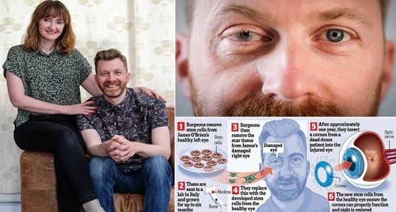 معجزة ربانية.. الخلايا الجذعية تعيد النظر لأربعيني بعد 26 عامًا