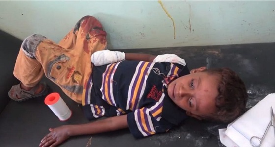 بالفيديو.. إصابة طفلين بقناصة الحوثي في حيس بالحديدة