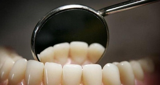 نصائح هامة لحماية أسنانك من التسوس