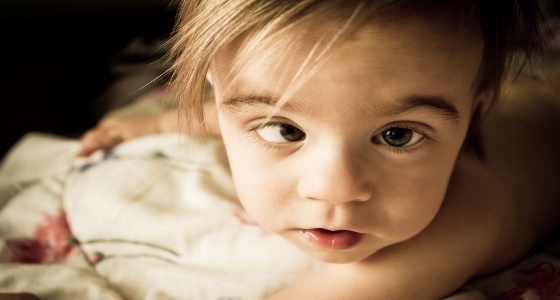 هل تنحرف عين طفلك؟.. نصائح هامة لإكتشاف الحول مبكرا والوقاية منه