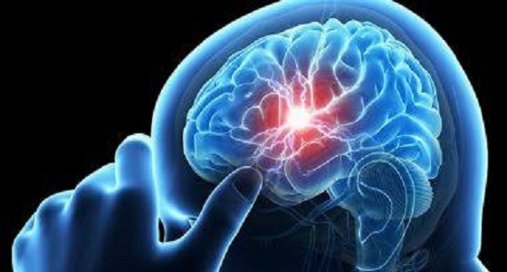 التعبير عن المشاعر يمنع الإصابة بالجلطة الدماغية 