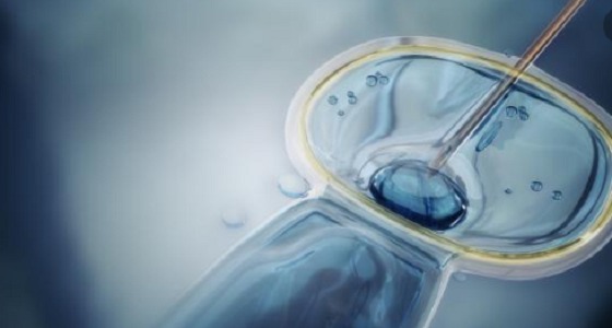 أسباب فشل عملية الحقن المجهري