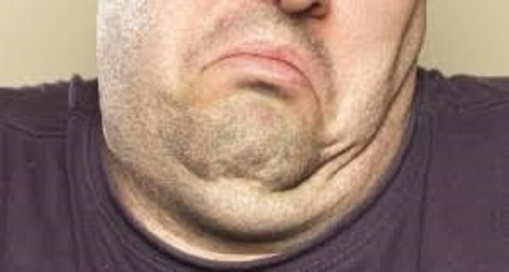 أفضل طريقة للتخلص من مشكلة سمنة الوجه والذقن