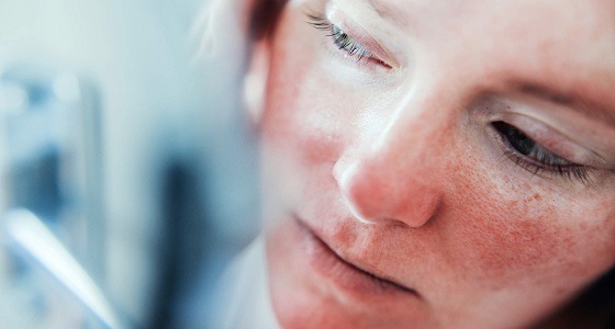 ابتعدي عن الشمس والتوتر.. نصائح هامة لحماية بشرتك من «الوردية»