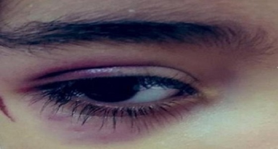 مالك الروضة يكشف تفاصيل تعرض الطفلة للإصابة في عينها وما طلبته والدتها منه