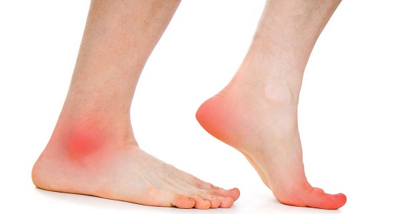طرق طبيعية لتخفيف ألم القدمين 