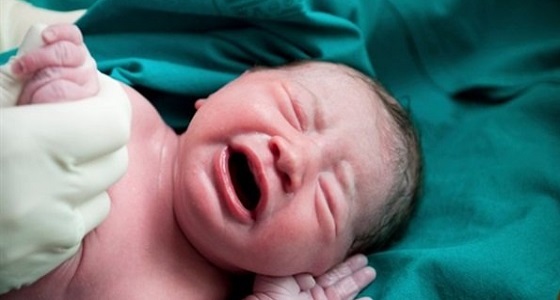 5 حالات تفرض عليكي الولادة قيصريا