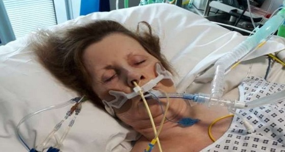 «خربوش قط» يصيب امرأة بغيبوبة وتوقف في القلب