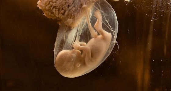 «عدوى فيروسية».. أسباب وأعراض موت الجنين في آخر شهور الحمل