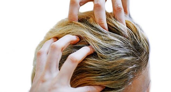 « الموز والليمون » .. كيفية التخلص من حكة الرأس