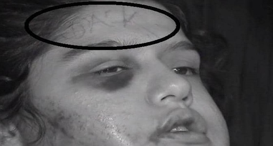علاقة «فيسبوك» تؤدي إلى اعتداء وحشي على فتاة عشرينية