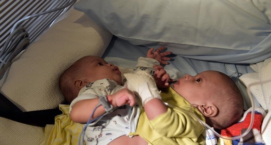 بالصور.. «السيامي الموريتاني» يصل إلى الرياض بتوجيهات خادم الحرمين