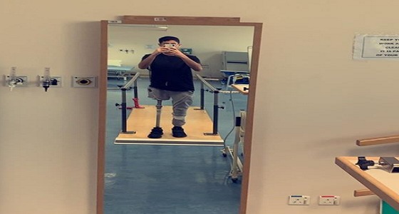 بعد 7 سنوات.. شاب ينشر صورته واقفاً لأول مرة بساق صناعية