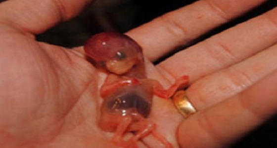 دراسة : الرجل سبب الإجهاض المتكرر