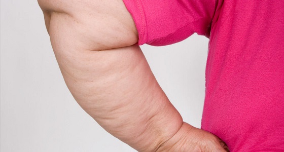 منها الفلفل الحار والشاي الأخضر.. أطعمة تفتت دهون الذراعين