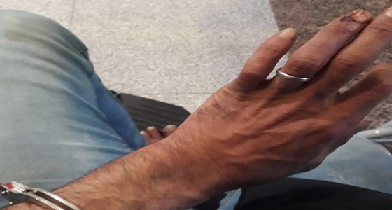 بالصور.. المخابرات التركية تختطف فلسطيني وتعذبه