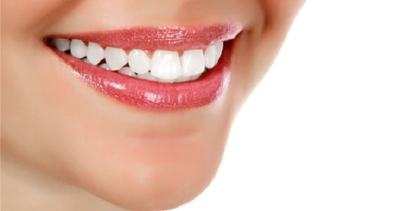 طريقة تركيب الهوليود سمايل لابتسامة جديدة