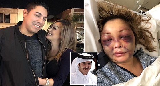فضيحة جديدة تورط شقيق أمير قطر في ضرب واغتصاب ممرضة أمريكية