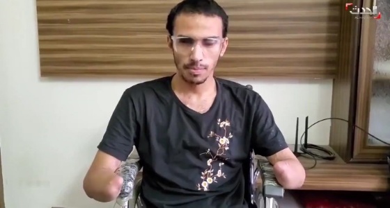 بالفيديو.. شاب يروي تفاصيل فقدانه لعينه وأطرافه بسبب الحوثيين