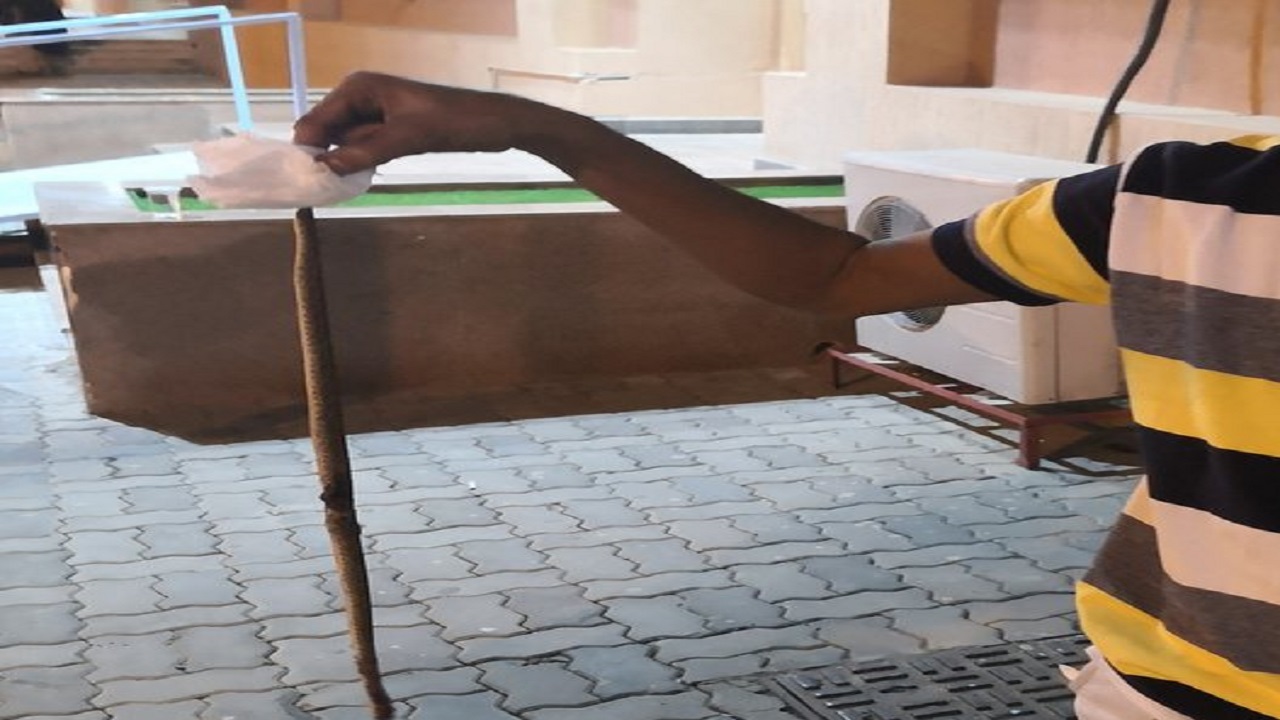 مواطن يدخل مستشفى حاملا ثعبان لمعاينته