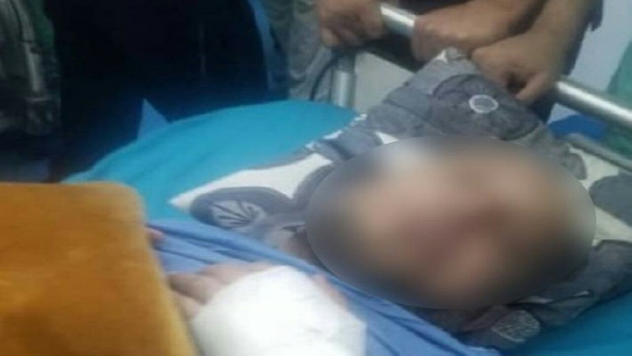 شاهد.. نائب أمين صنعاء يتعرض لمحاولة اغتيال فاشلة