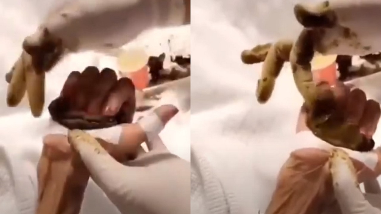 بالفيديو..ممرضة تضع الحناء لمريضة في أول أيام العيد