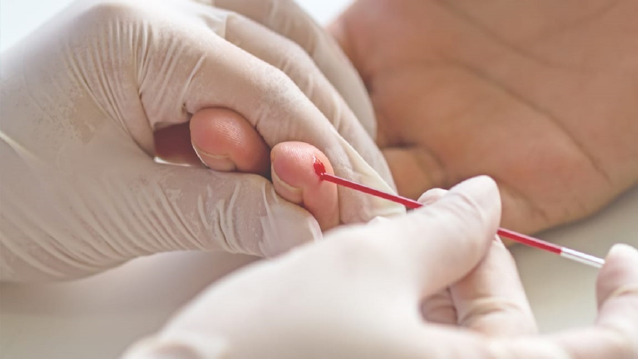 خالد النمر يوجه نصيحة إلى حواء: «لا تهملي علاج فقر الدم»