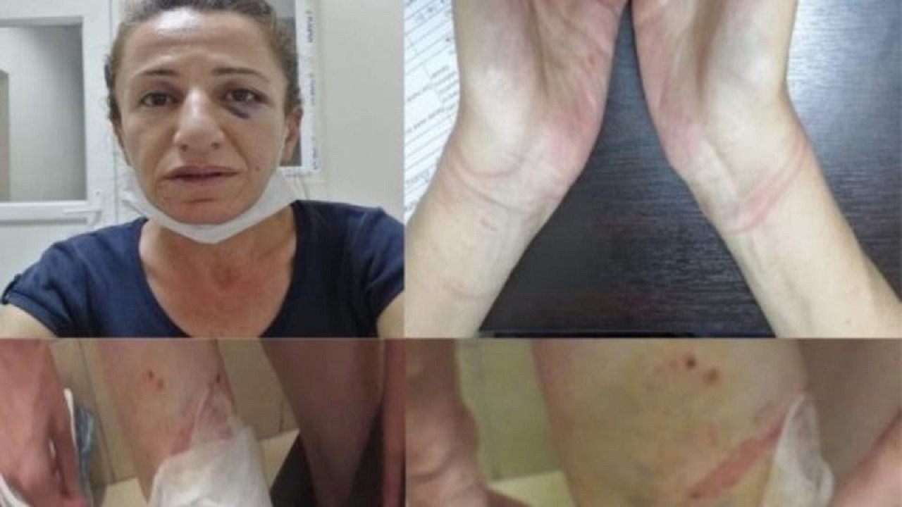 تعذيب معارضة لـ3 ساعات ونصف يثير الغضب في تركيا