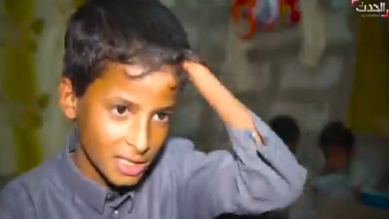 طفل يمني يفقد أطرافه بسبب الألغام الحوثية (فيديو)