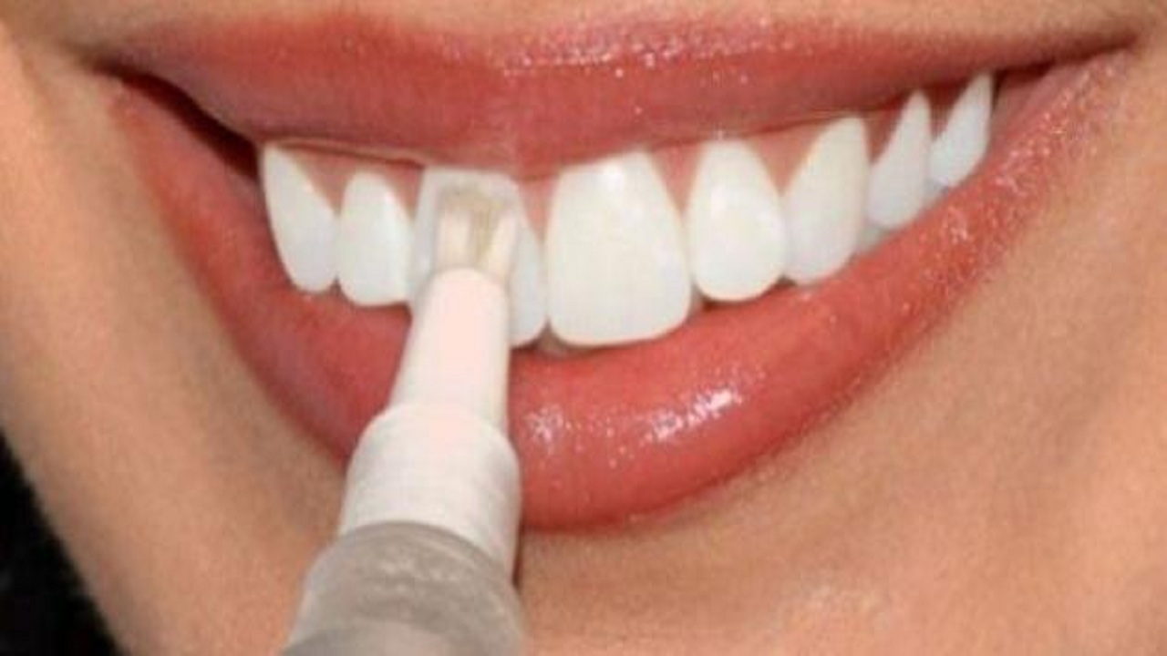 بالفيديو.. انتشار تحدِ خطير يُدمر الأسنان