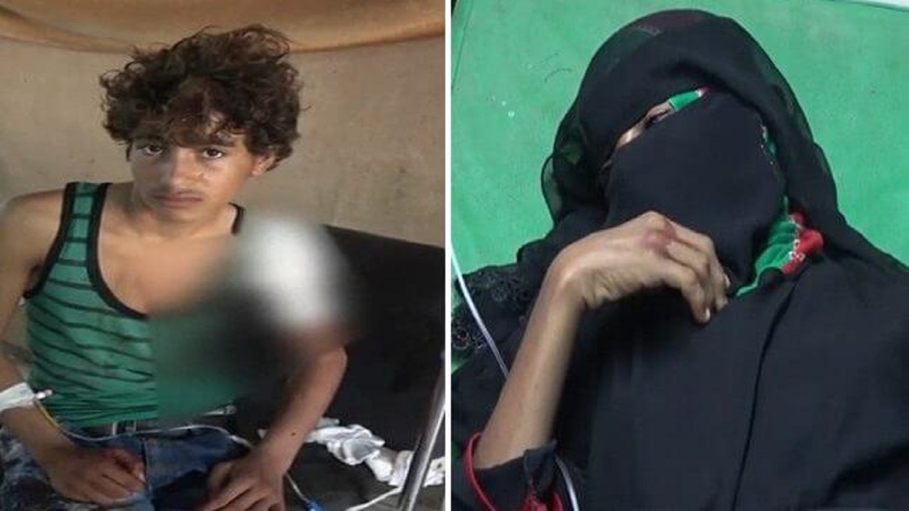مصرع وإصابة 4 أشخاص في جرائم قنص ارتكبتها مليشيات الحوثي &#8220;فيديو&#8221;