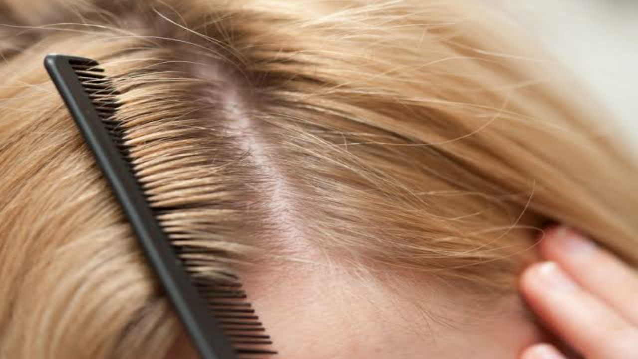 خلطة بيكربونات الصودا لتفتيح لون الشعر 
