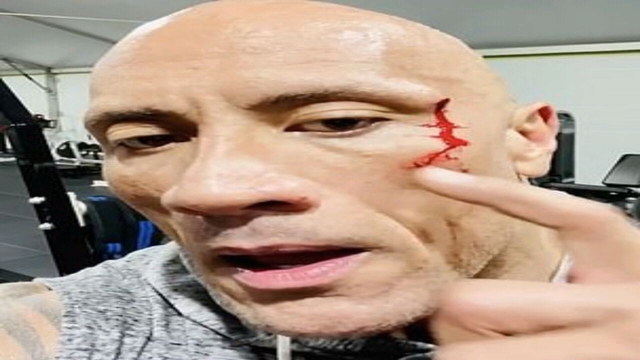 بالفيديو.. &#8220;ذا روك&#8221; يتذوق دمه بعد إصابته: مثل الصلصة الحمراء