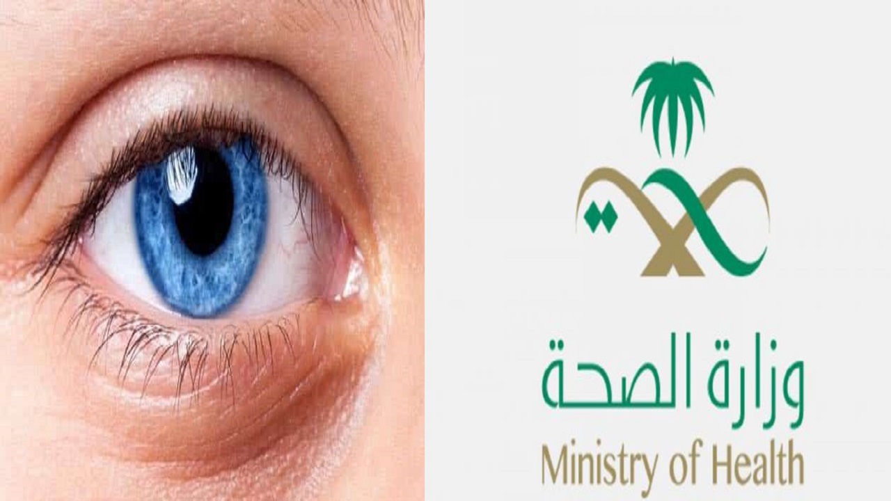 &#8220;الصحة&#8221; تنشر إنفوجرافيك تعريفيًا لأهم فحوصات العيون في مرافقها الصحية