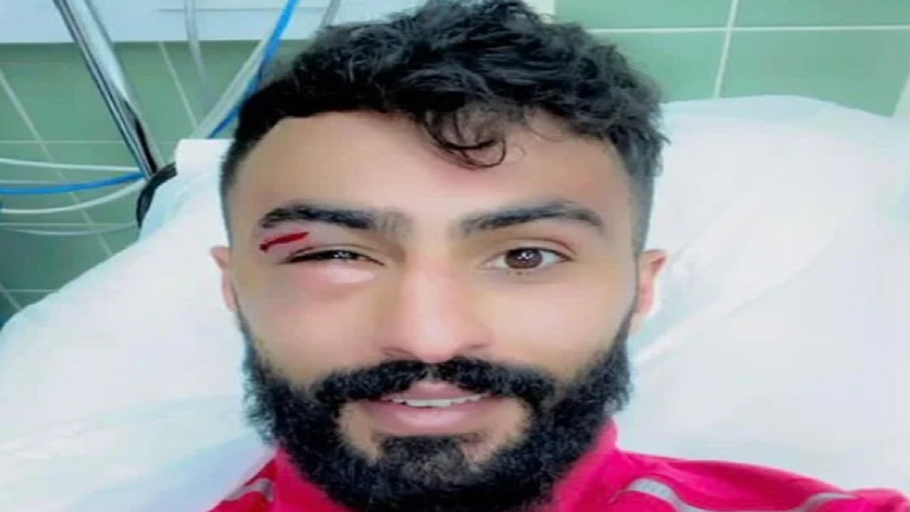 إصابة أحمد الحبيب نجم أبها في العين اليمنى