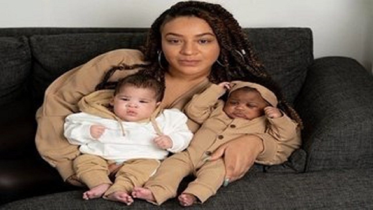 بالصور.. امرأة تنجب طفلتين توأم بلوني بشرة مختلفين