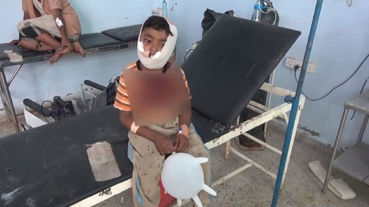 شاهد.. إصابة طفل يمني برصاص قناصة الحوثي