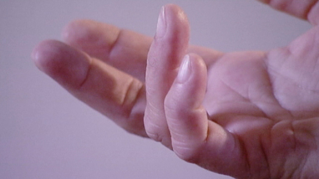 تغير شكل الأصابع من علامات الإصابة بسرطان الرئة