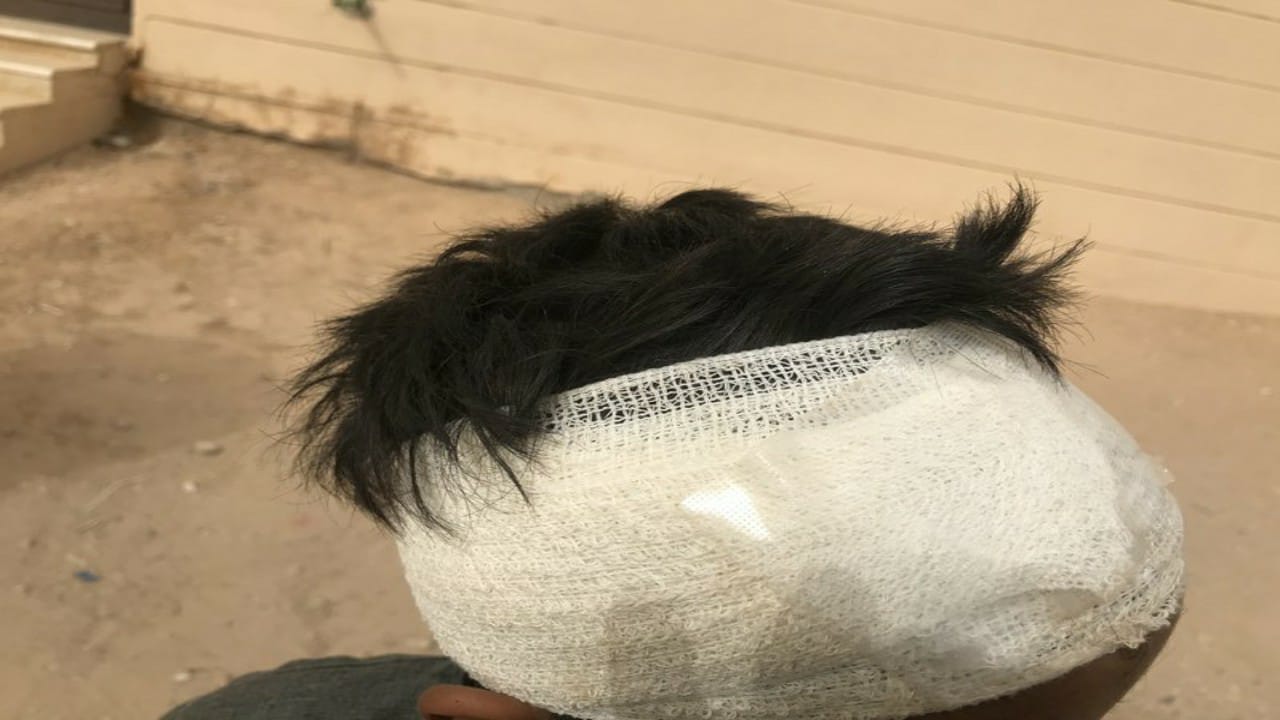 كلب ضال يهاجم طفلًا في الأفلاج ويصيبه بجرح عميق 