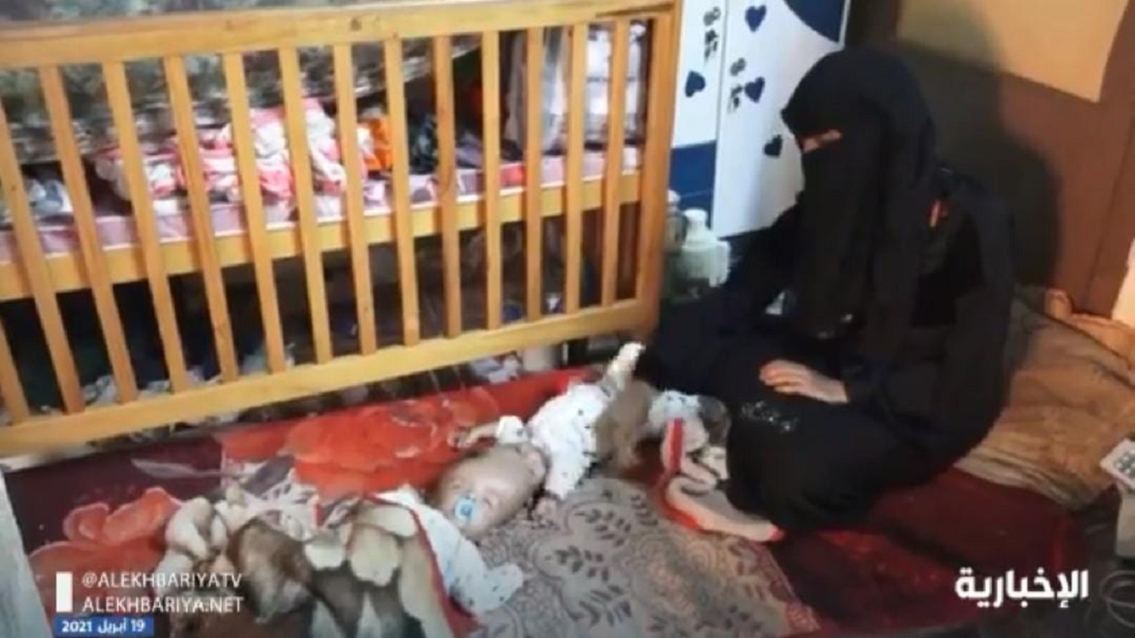 بالفيديو.. أم التوأم السيامي اليمني تصف شعورها بعد توجيه الملك سلمان بإجراء عملية الفصل 