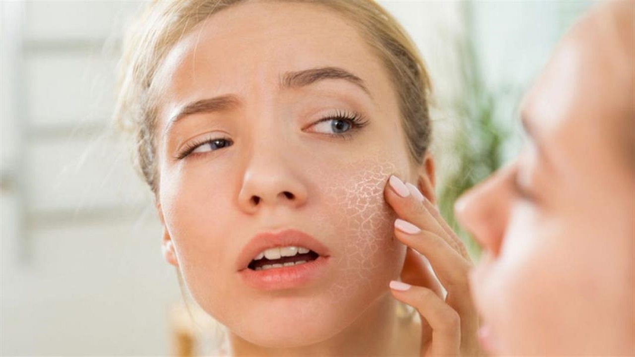 طرق طبيعية سهلة للتخلص من جفاف بشرتك بعد الصيام