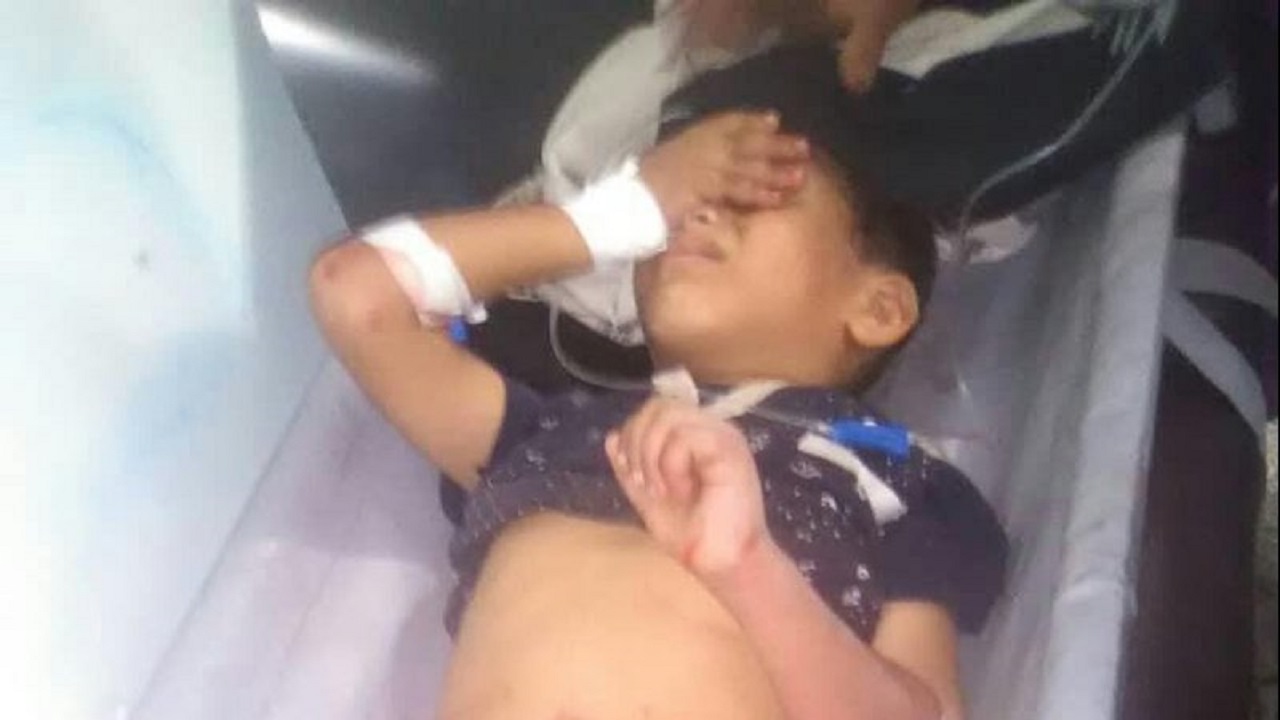 مقتل 3 أطفال بنيران حوثية في &#8221; إب &#8220;