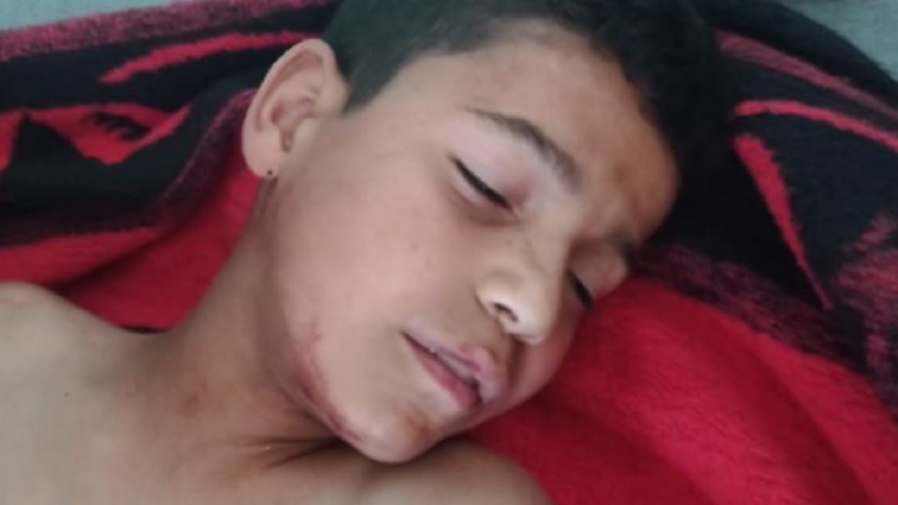 إصابة طفل برصاص حرس الحدود التركي وهو يلهو مع أصدقائه