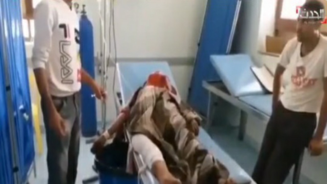 شاهد.. إصابة سيدة يمنية بشظايا لغم حوثي في حيس باليمن