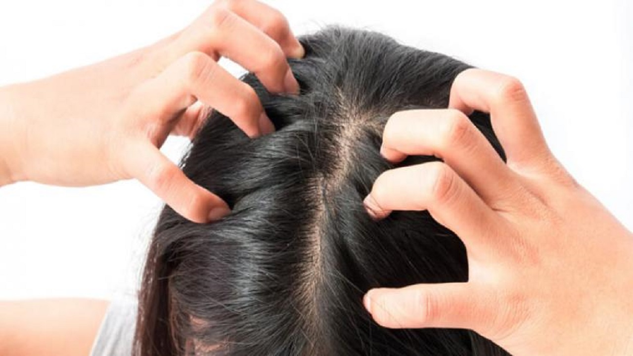وصفة طبيعية لعلاج جفاف الشعر وحكّة فروة الرأس